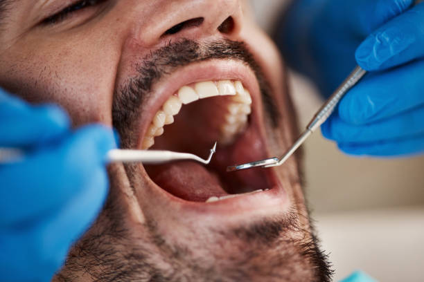 Sedation Dentistry in Cadiz, OH