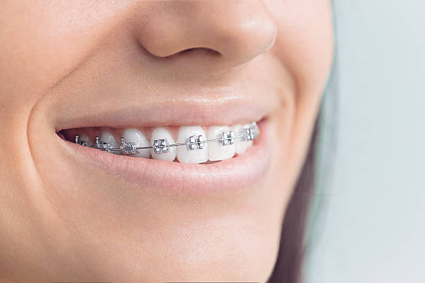 Best Traditional Braces  in Cadiz, OH